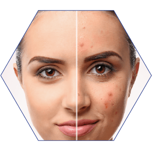 Skin care and wound healing